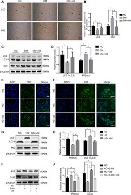 Vildagliptin Attenuates Myocardial Dysfunction and Restores Autophagy via miR-21/SPRY1/ERK in Diabetic Mice Heart